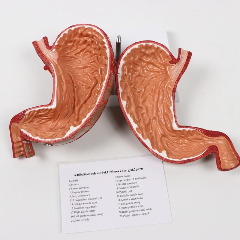 Medical Science Human Digestive System Pathological Stomach Anatomy Model For Education