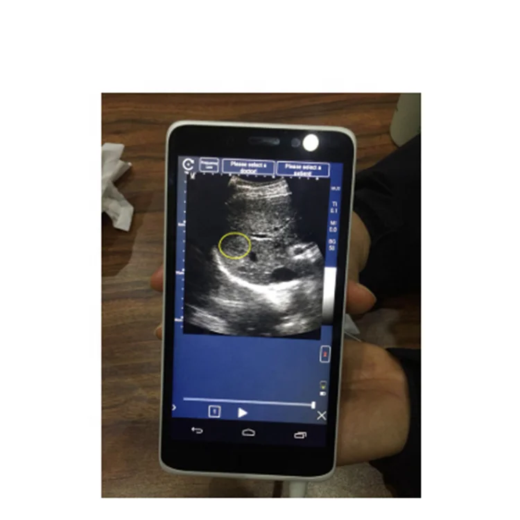Healson Medical Ultrasound Machine With Color Doppler Usg