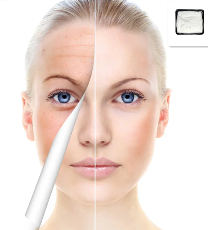 Whitening Cosmetic Raw Material Phenylethyl Resorcinol 377 Powder With Good Quality  cas 85-27-8