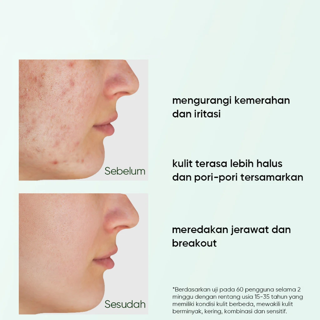 Glowing Clay Mask for Cleansing  Hydrating  Exfoliating and Purifying Clay Mask Rare Earth Deep Pore Cleansing Clay Mask