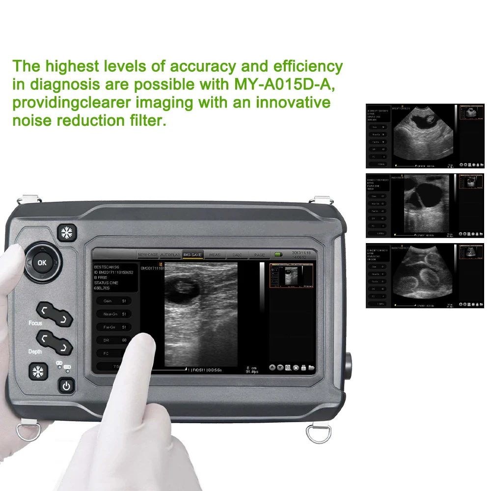Electric Medical Ultrasound Instruments portable wifi ultrasound probe veterinary medical ultrasound machine