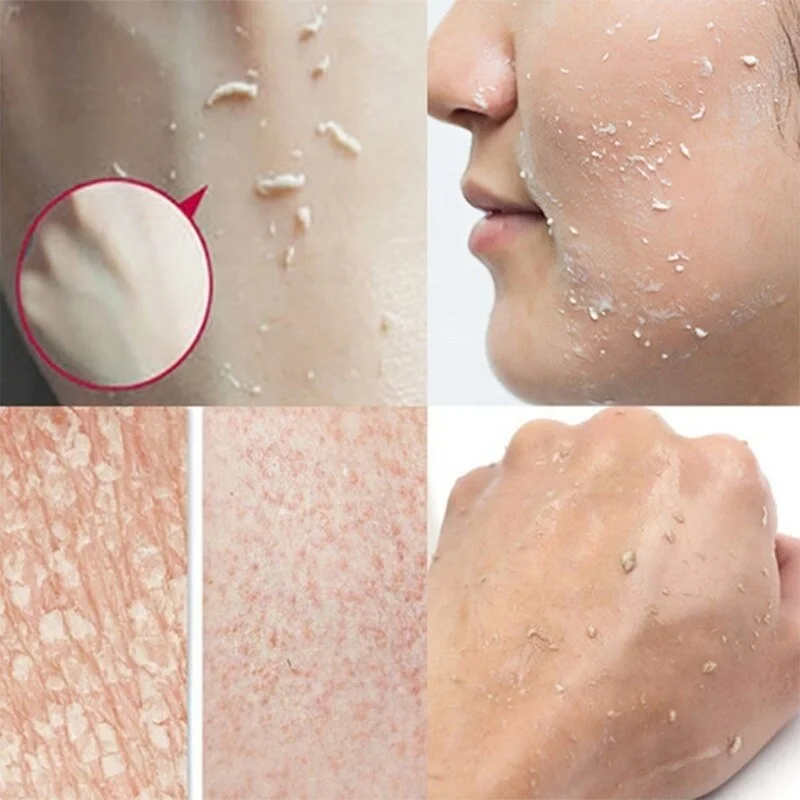 Lemon Sparkling Peeling Gel Facial Scrub Cleanser Gel Skin Care Whitening Acne Blackhead Exfoliating Gel