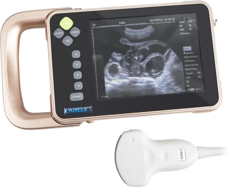 Use Veterinary Ultrasound Scanner for Farm Touch Screen Animal 8kg Normal Temperature