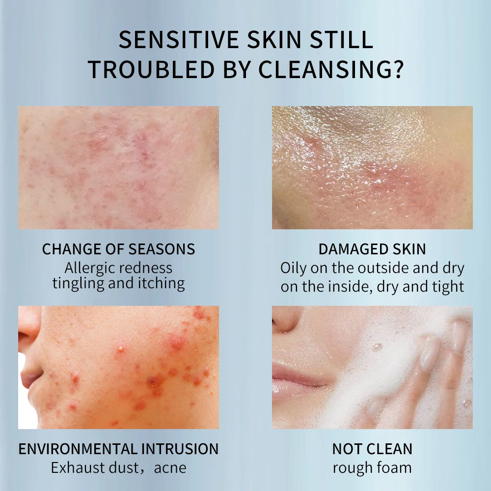 Organic Vitamin C Facial Care Kit Vc Foaming Face Cleanser Vitamin C Facial Wash Hyaluronic Acid Face Cream Skin Care Products