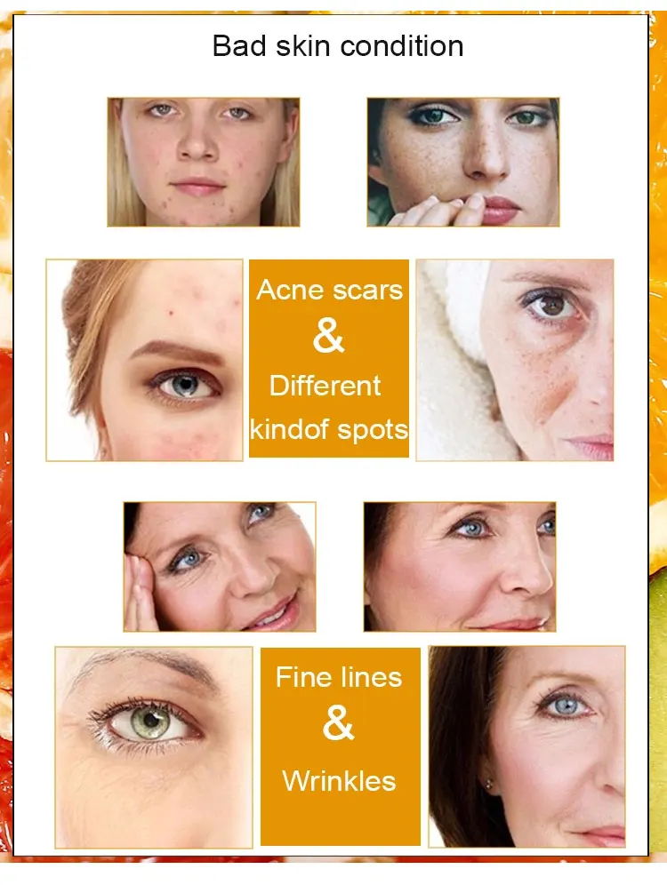 Oem увлажняющая Успокаивающая восстанавливающая сыворотка для ухода за кожей