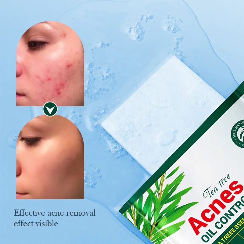 Vegan Tea Tree Essential Blemish Oil Control Mask Daily Soothing Calming Moisturizing Anti Acne Clear Pores Facial Sheet Mask