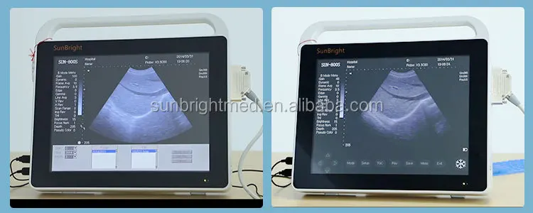 Digital Ecograph Touch Function Laptop Portable Black and White Ultrasound Machine SUN-800S