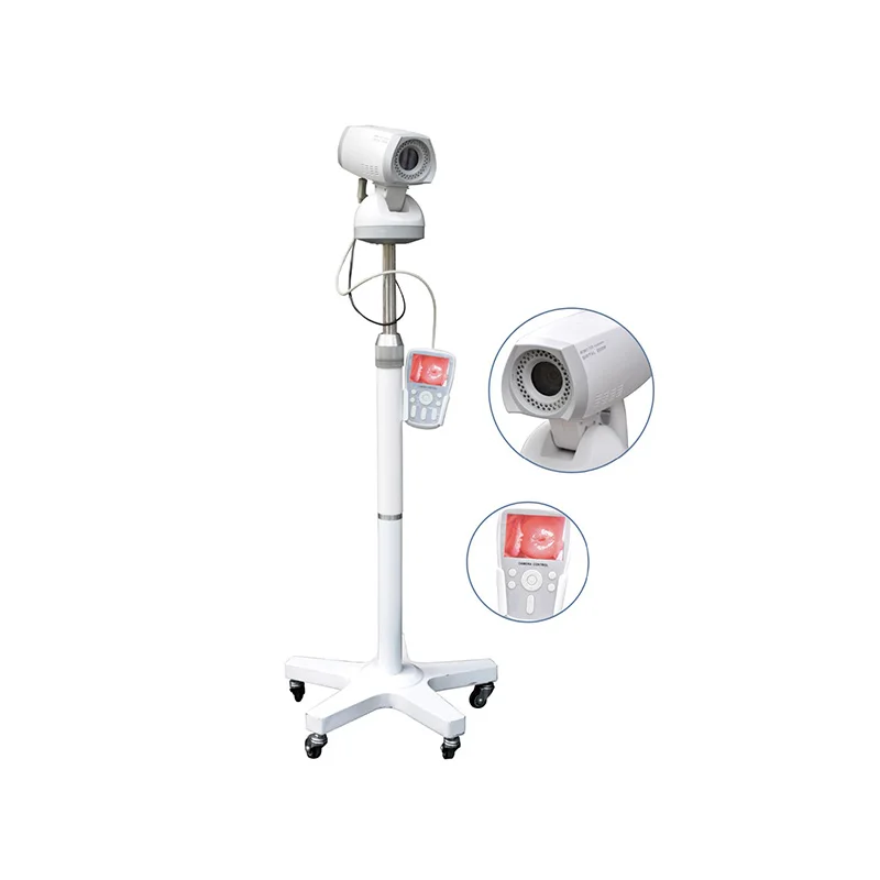 HD Video Colposcope For Vagina Digital Gynecology Portable Handheld Camera System colposcope cheapest