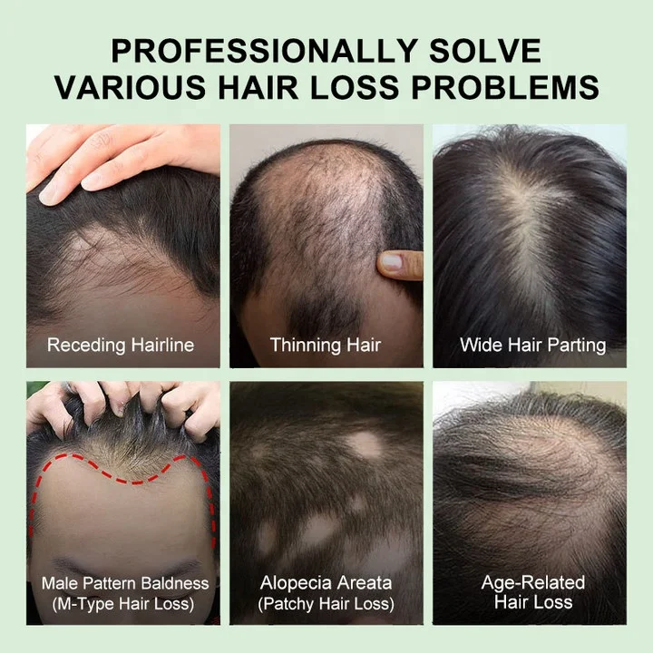 Rosemary Scalp Oil Organic Natural 7 Days Hair Tonic Free Hair Growth Oil for Alopecia Gallon Big Bottle Serum