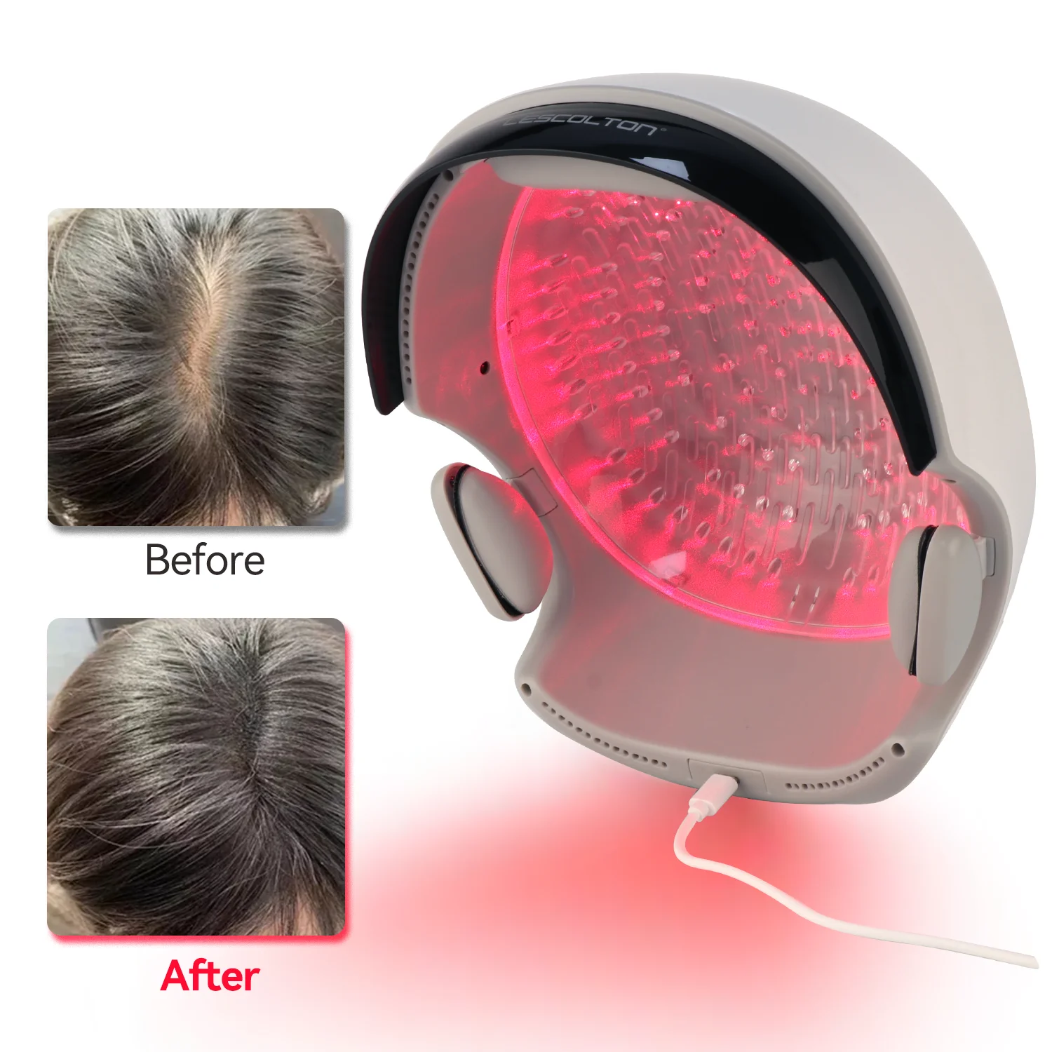 hair growth red light therapy helmet Hair infrared red light therapy equipment red light therapy helmet Hair Loss Treatment