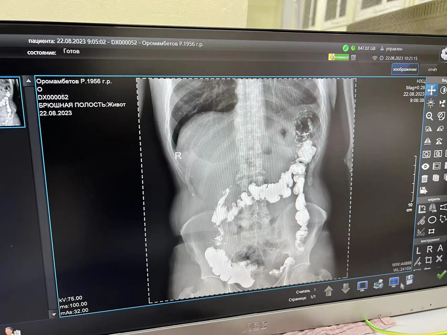 With Wholesale of new products  PLD5600A double column DR System Power supply frequency x-ray medical imaging machine