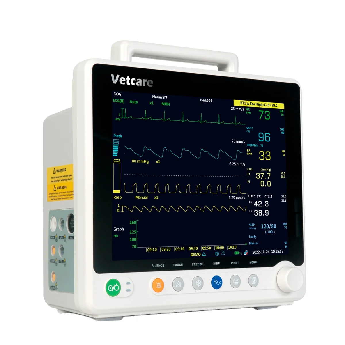 Remote Monitoring Devices Multiparameter System Icu Multi Parameter Medical Portable Patient Monitor