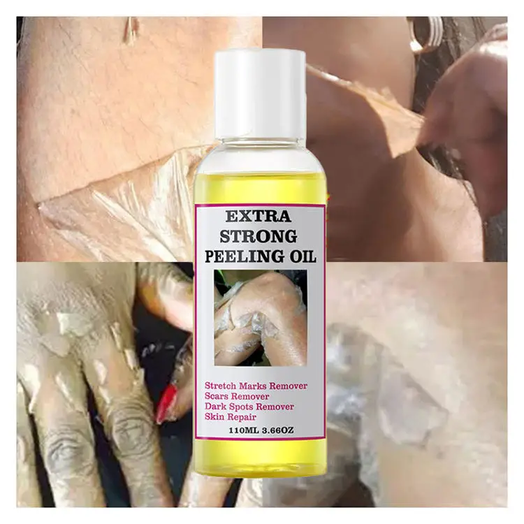 extra strong yellow orange peeling oil very strong body dried tangerine skin peeling oil for stretch marks lightening