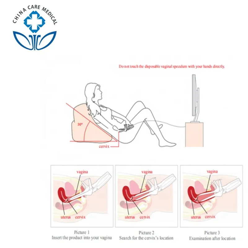 
Portable Electronic Mini Cervical Video Colposcopy Colposcope Culposcope Camera Machine Equipment For Gynecology In China 