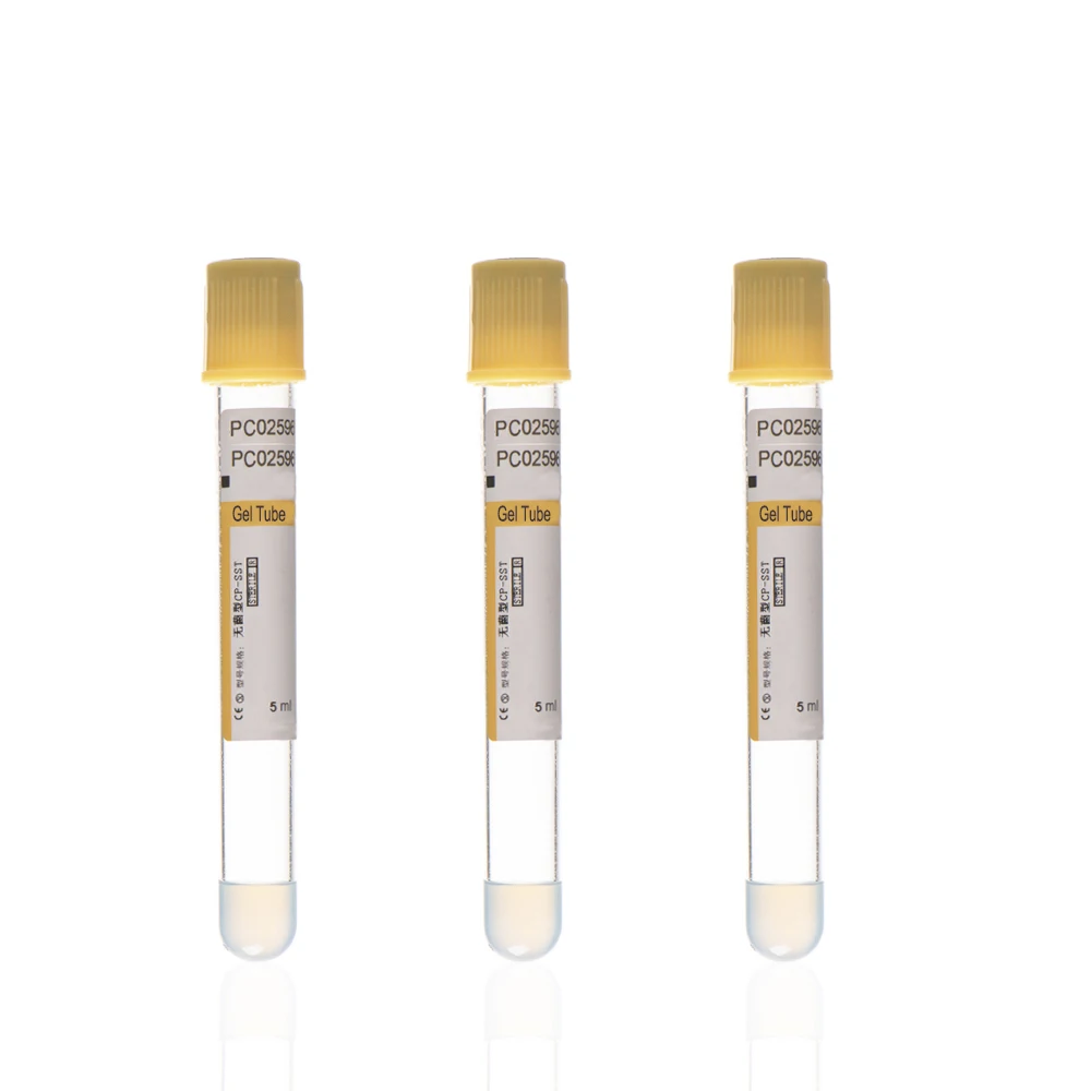 Factory Direct Sales Of High Quality Disposable Vacuum Blood Sample Collection Tubes