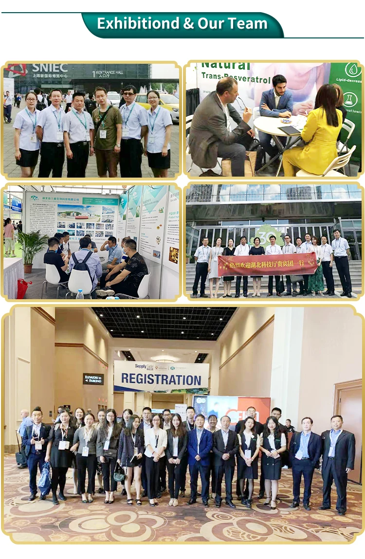 Gamma Poly Glutamic Food Supplements Factory Supplier Antioxidant Food And Cosmetic Grade Alpha Lipoic Acid Thioctic Acid