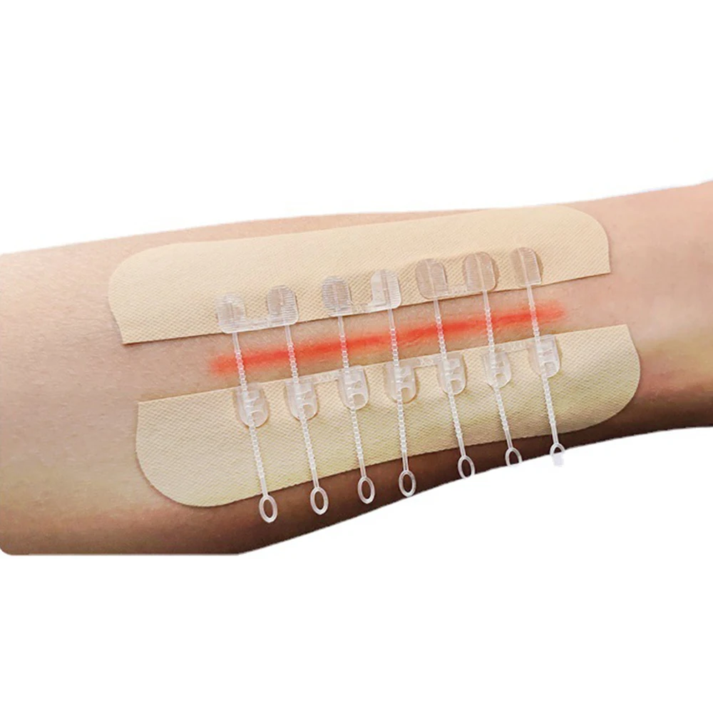 Wound Plaster Wound Closure Zipper Transparent Wound Dressing Skin Closure Strip Bandage