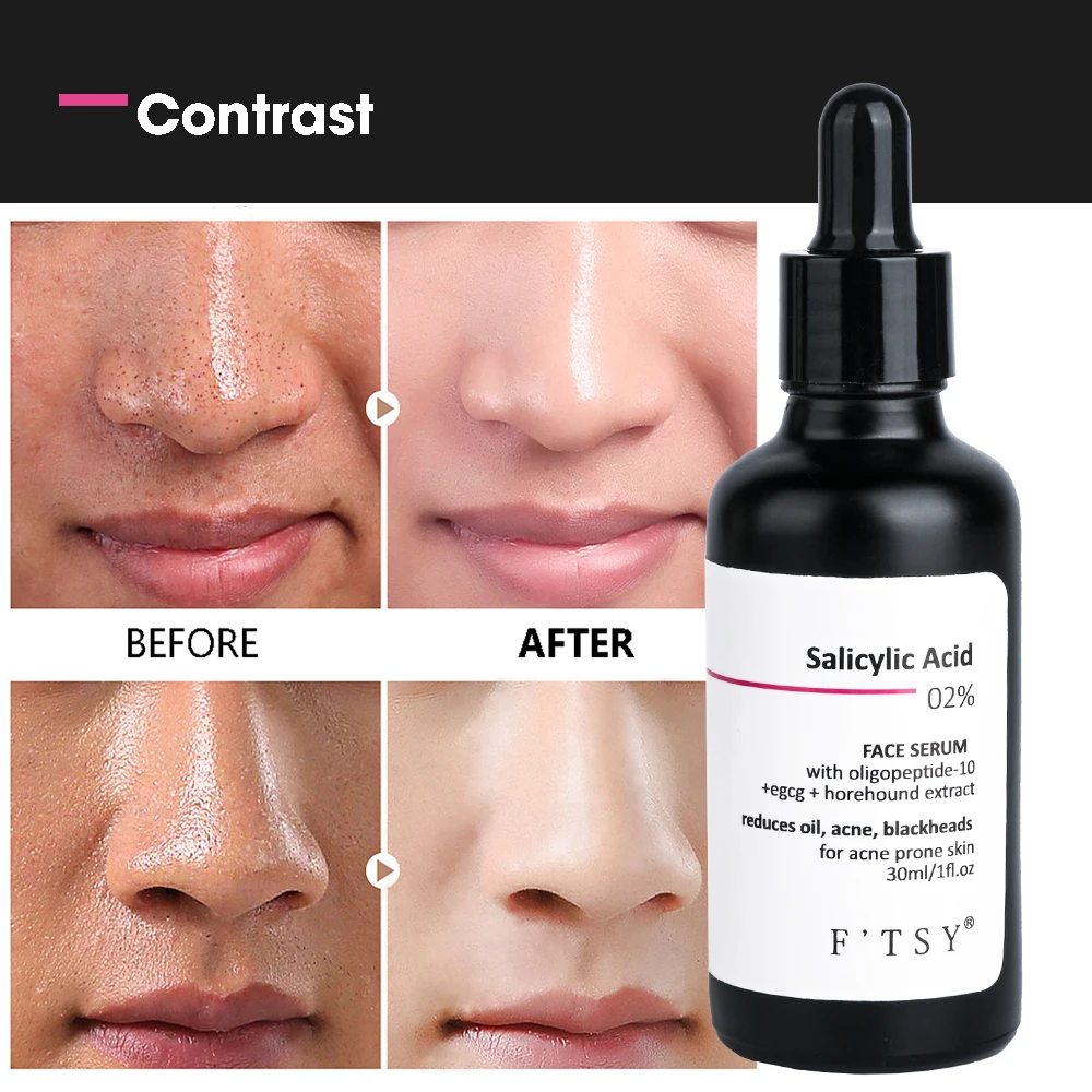 Salicylic Acid Serum for Face Blackhead Acne Removal with Hyaluronic Acid Herbal Ingredients Pore Shrinking Feature Liquid Form
