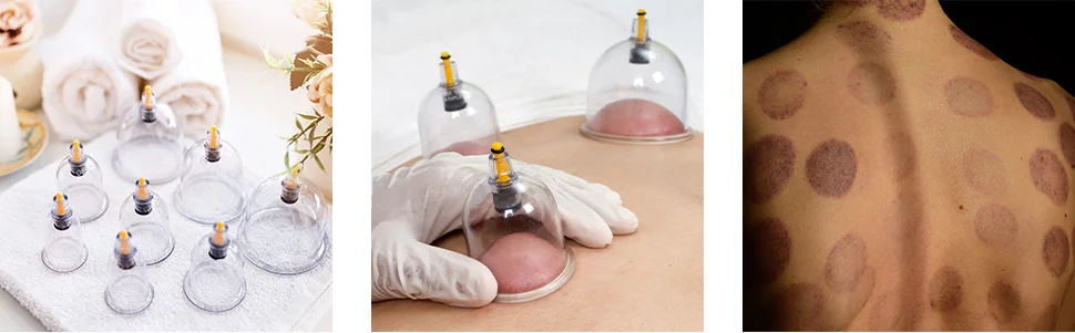 Chinese cheap hijama set negative pressure cupping machine hijama 12 suction cup kit cupping tool
