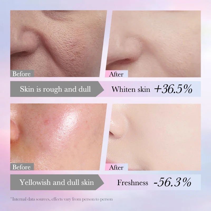 OEM SADOER private label niacinamide beauty skin care products spot remoral repair firming nourishing face whitening lotion