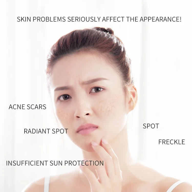 OEM Hot Sale Face Cream Dark Spot Corrector Skin Care refreshments Whitening Freckle Removing Cream
