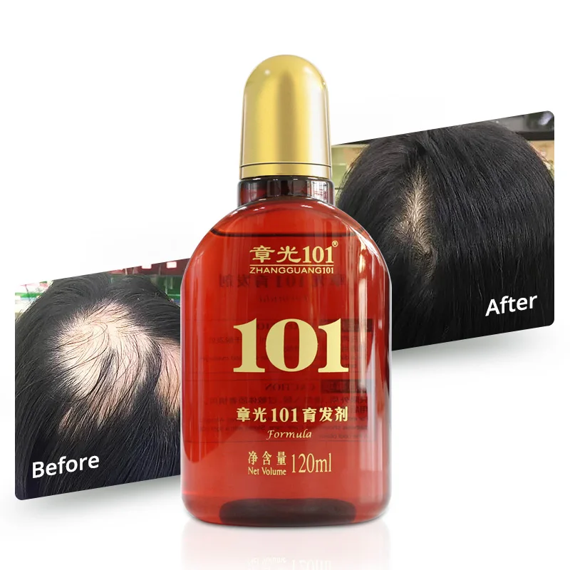 Custom Logo Ginger Extract Natural Hair Growth Treatment Serum