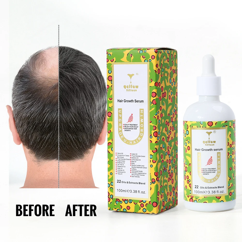 Private Logo Biotin Hair Growth Serum Regrowth Treatment for Scalp Loss Hair Thinning Natural Hair Growth