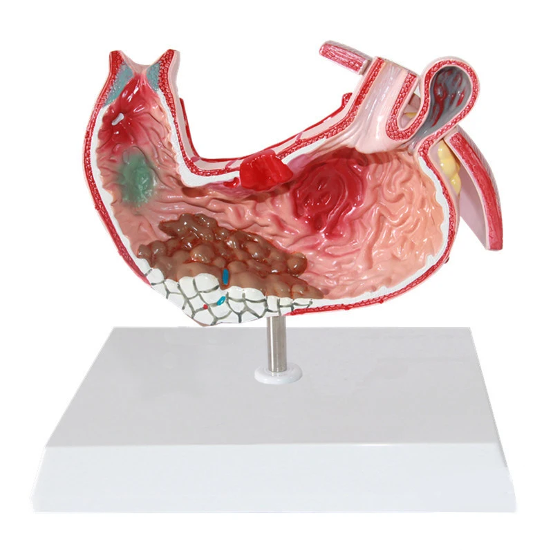 Stomach Pathological Section Model Human Stomach Anatomical Model For Medical School