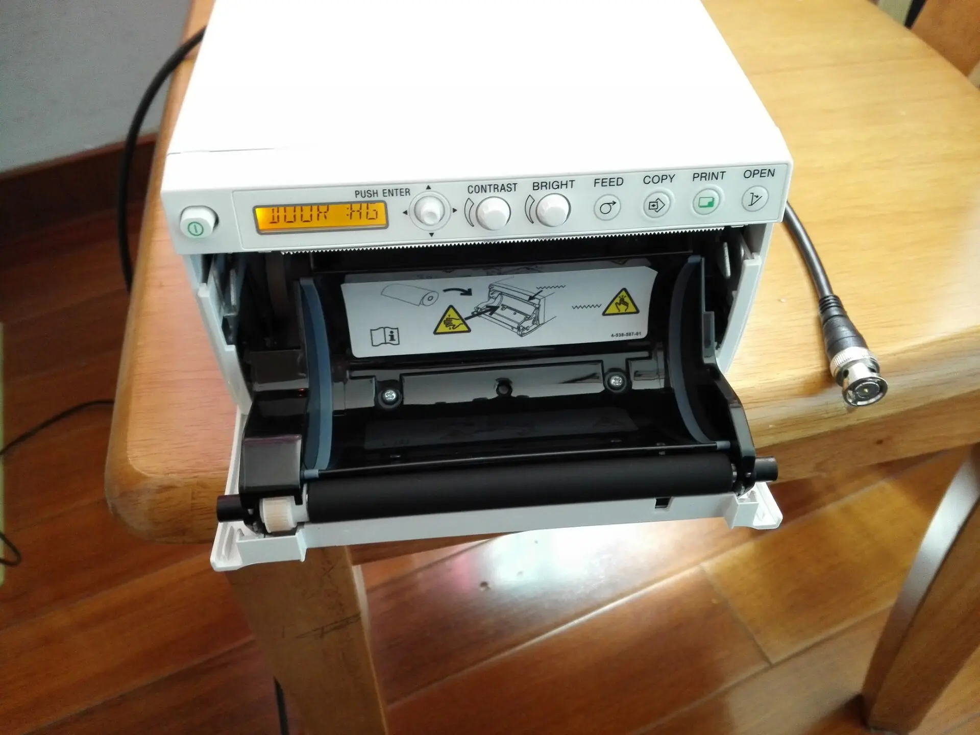  Самый дешевый цифровой SONY UP-898MD ультразвуковой