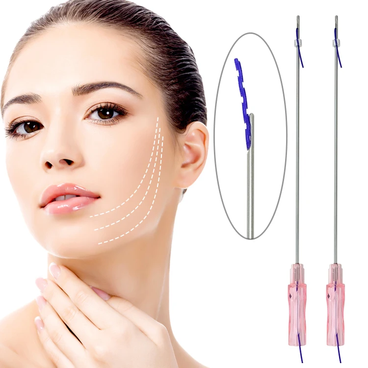 Molding cog pdo thread (3)