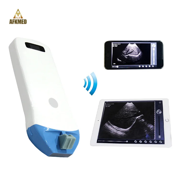 Professional portable doppler ultrasound handheld device color scan systems handheld ultrasound scanner