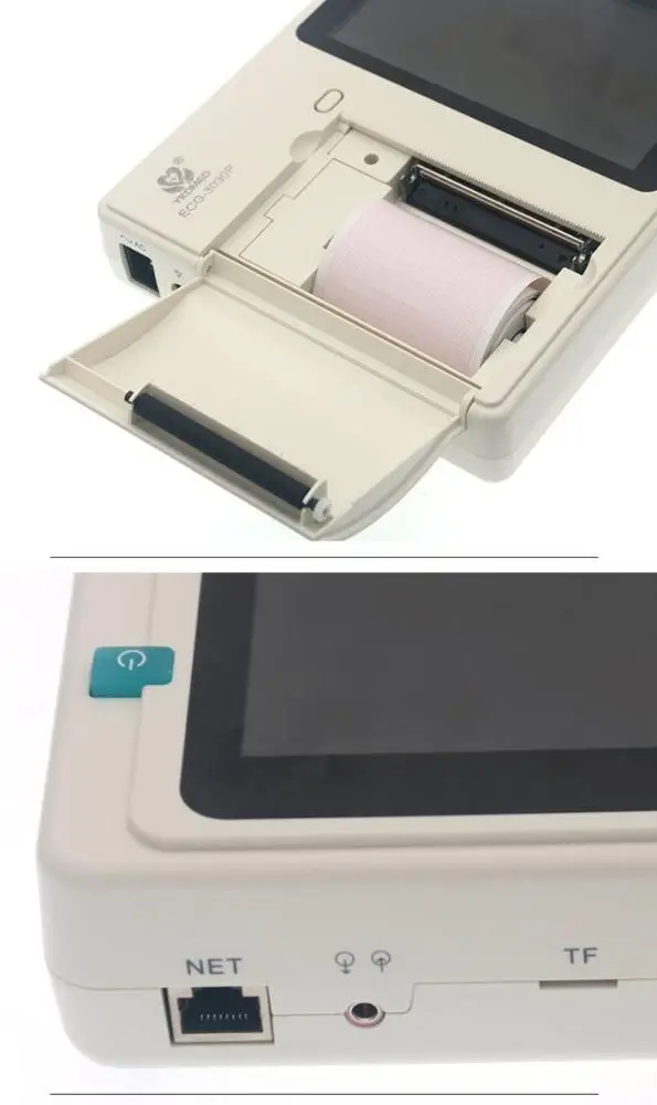 3 Channel Electrocardiogramm Electronic Home Handheld ECG Heart Machine Portable EKG Device YKD ECG-3030P Ecg/Ekg Machine