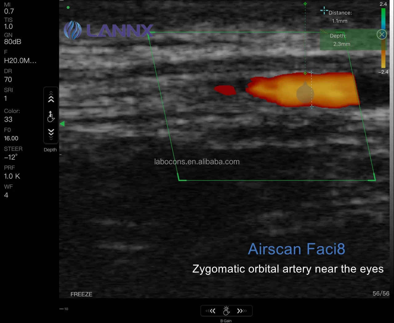 LANNX Airscan Faci8 Medical Women Cosmetic Facial Echocardiography Handheld probe Ultrasound Portable wireless Ultrasound probe