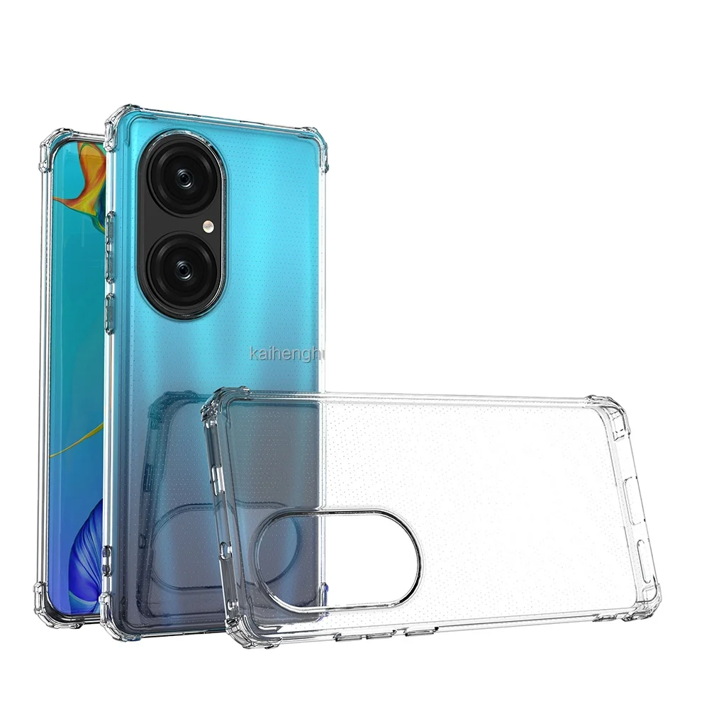 For LG K61  K40S
 K50S
 Case Tpu Electroplate  Phone Cover Case for LG  Stylo 6
 K51/Q51
 K41S
 K51S