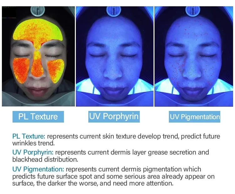 skin analyzer (11).jpg