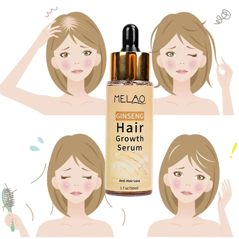 OEM 100% Pure Natural Organic Scalp Essential Oils Anti Hair Loss Product Ginseng Hair Growth Serum