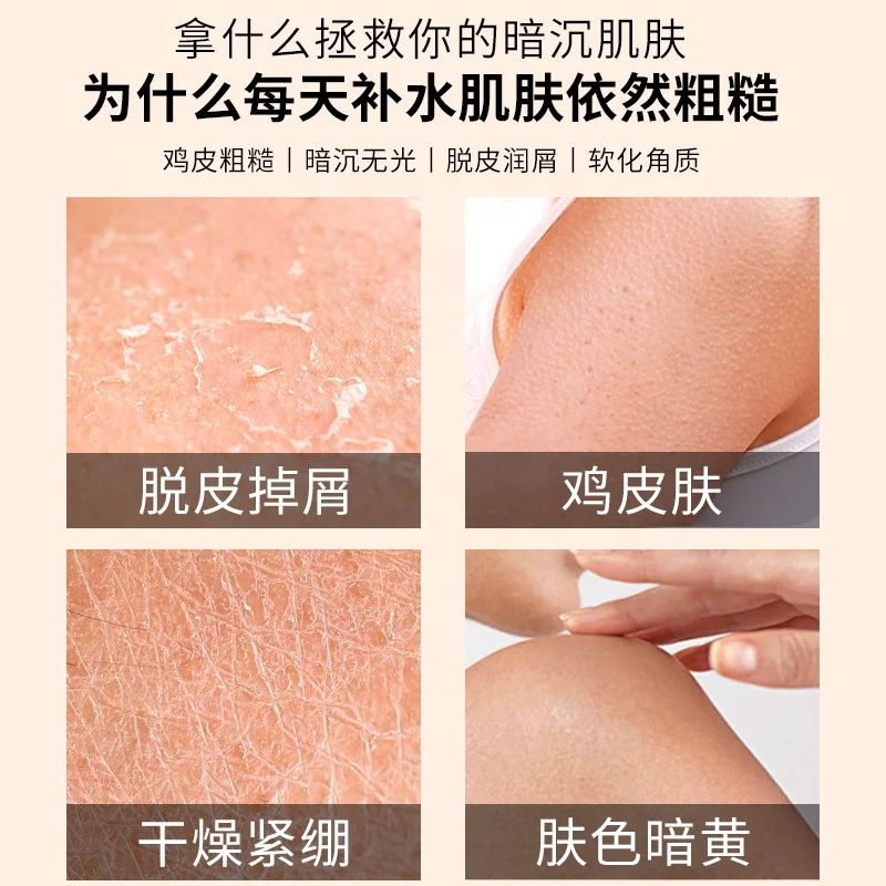 Wholesale Vegan Herbal Body Care Products Especially Suitable For Chicken Skin, Dry Skin Urea Vitamin E Skin Repair Lotion