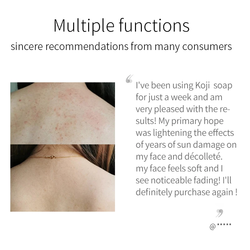 Beauty Natural Collagen Acne Dark Spot Remover Skin Whitening Lightening Bathing Soap for Face Hand Body Washing