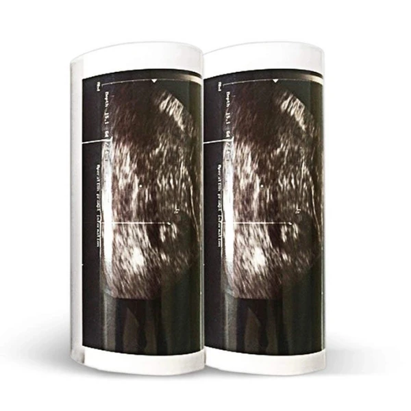 Factory Direct Supply UPP 110HG Ultrasound Paper Clear Image TYPE V Ultrasound Paper