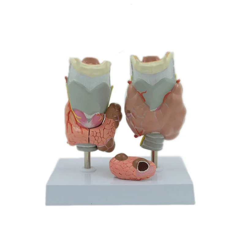 Medical teaching Thyroid pathology models Endocrinology Display of thyroid disease for medical anatomy