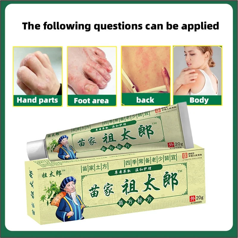 Anti-inflammatory Itching Relieve Skin Herbal  Disease Relieve Itching Pruritus Psoriasis Cream Ointment