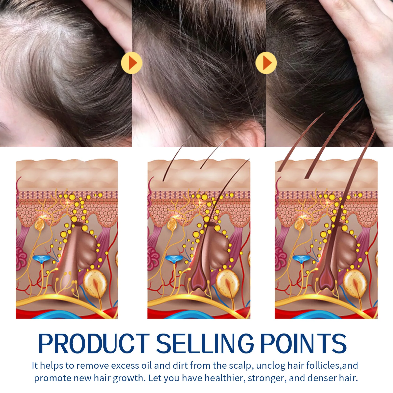 Hair Scrub Cream Cleanses Scalp, Cuticles, Relieves Itch, Moisturizes, Firms, and Prevents Hair Loss