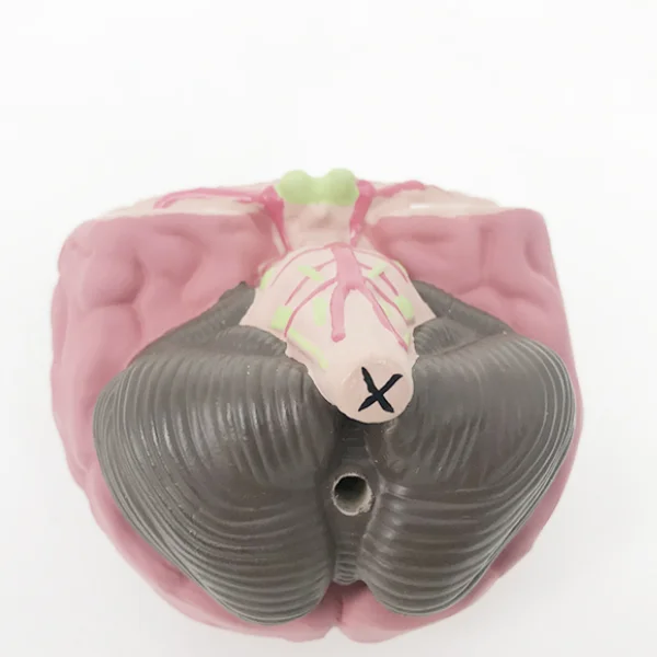 BMN/N051 Brain Stroke Model (Brain Disease Model)