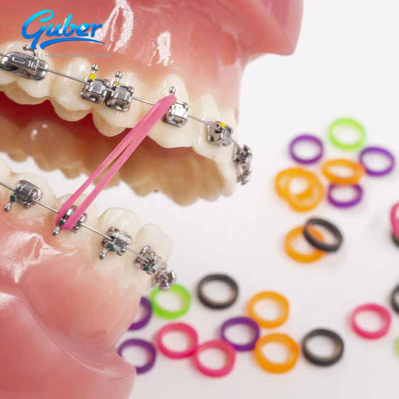 ISO Certified Orthodontic Braces Elastic Rubber Bands Placer100pcs Colorful Orthodontic Ligature Directors Dental Equipments