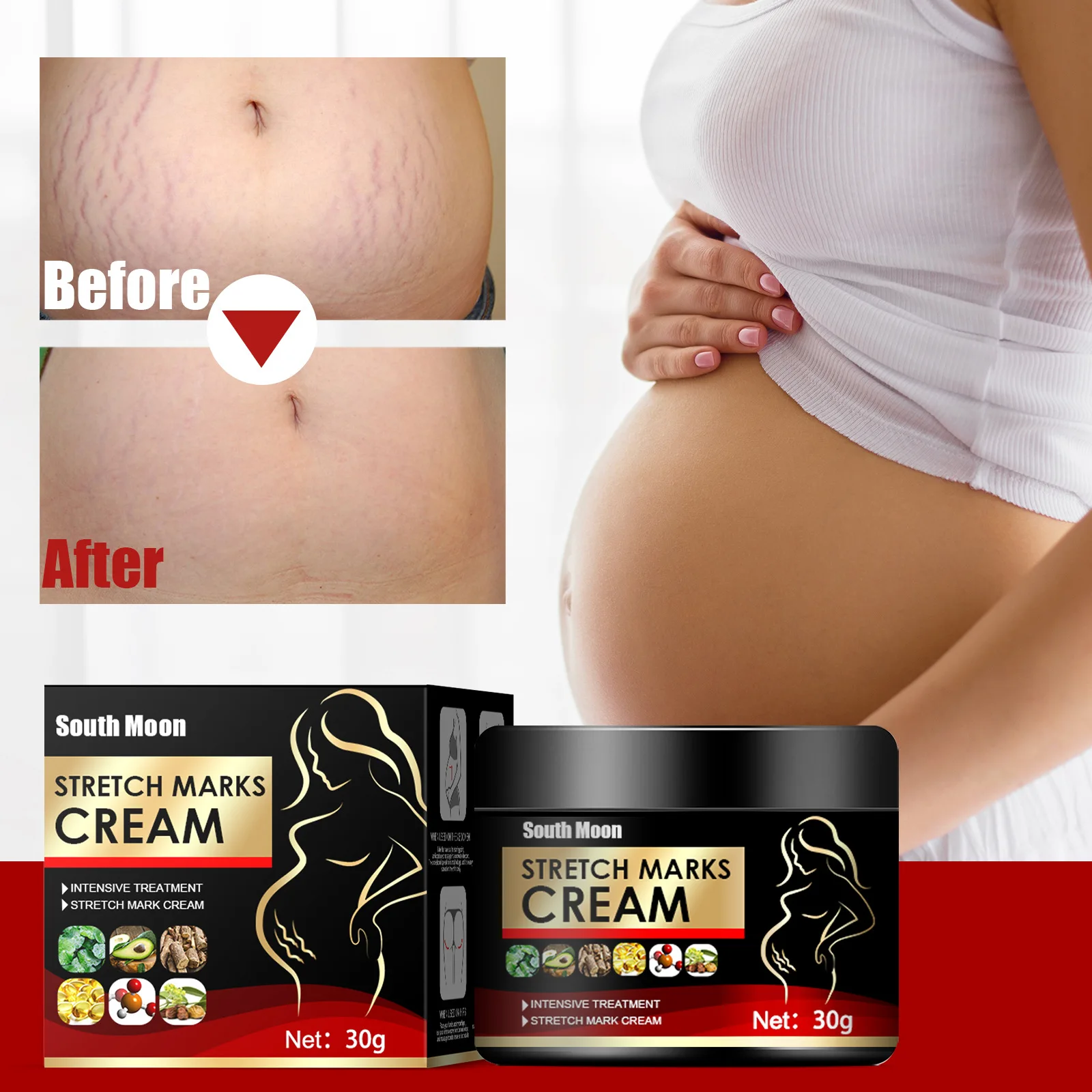 South Moon Stretch Mark Repair Cream Maternity Fades Postpartum Fat Growth Orange Peel Improve Scar Remover Skin Care Body