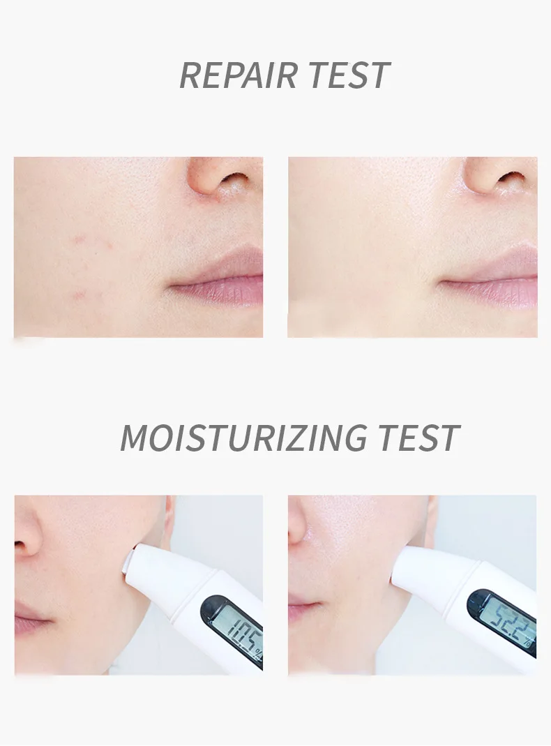 Wholesale Private Label Handmade Natural Lemon Flavor Brightening Body Bleaching Face Lightening Skin Whitening Lemon Bar Soap