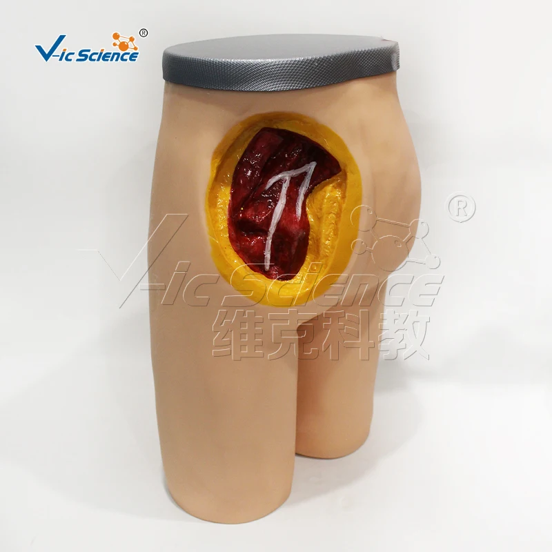 Advanced Gluteal  Anterior Superior Iliac Spine Posterior Superior Iliac Spine Muscle Injection and Anatomical Structure Model