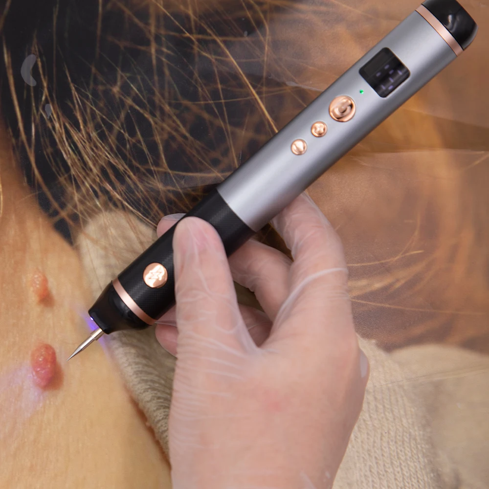 Plasma pen freckles remove and wrinkles plasma lift pen scrubber skin tightening spot mole removal plamere needles pamere pen