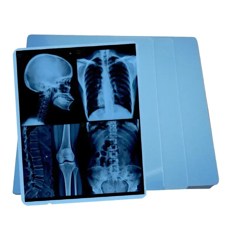 Inkjet Blue Medical dry film transparent blue xray film for CT DR MRI Radiological device
