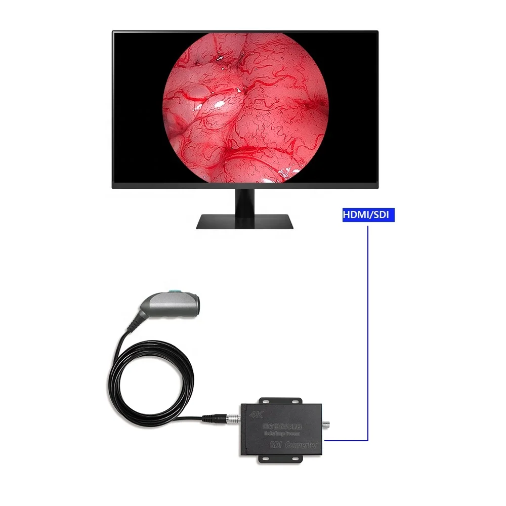 Portable 4K Medical Endoscopic Camera Converter For Laparoscopy Ent Sinuscope Hospital Surgical Device Medical Equipment